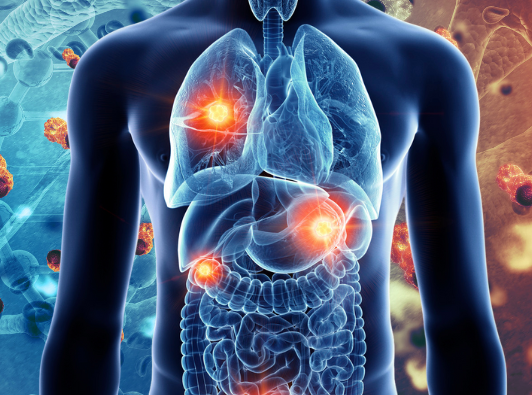 Usage of BPC-157 in Cancer Treatment